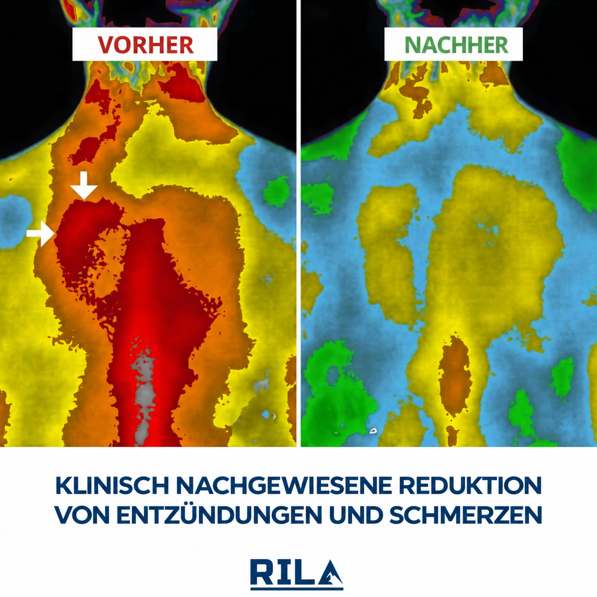 Eine Flasche, die Wasser in 3 Minuten „lebendig“ macht, damit du dich 10 Jahre jünger fühlst
